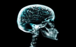 Ученые рассказали, что происходит в мозге человека на последних секундах жизни.